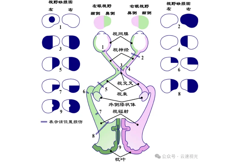 双眼视功能示意