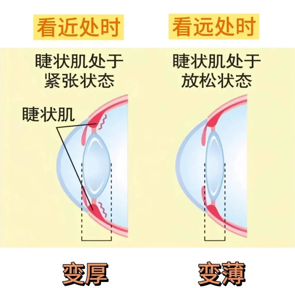 睫状肌调节状态